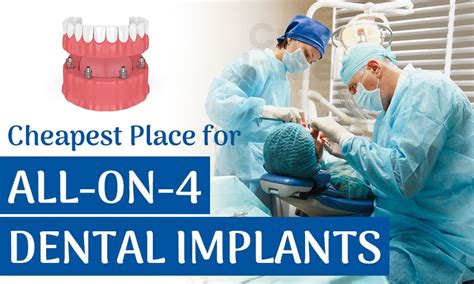 where are the cheapest dental implants